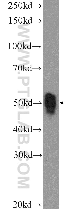 Western Blot (WB) analysis of Jurkat cells using ETS1 Polyclonal antibody (12118-1-AP)