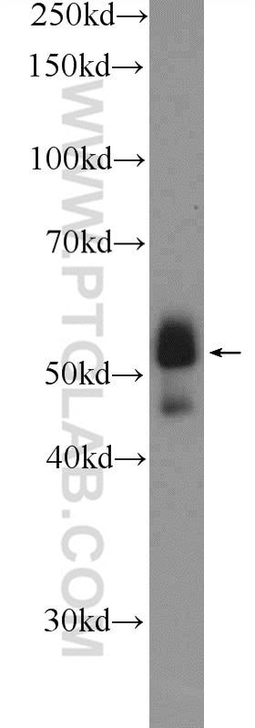 Western Blot (WB) analysis of mouse thymus tissue using ETS1 Polyclonal antibody (12118-1-AP)