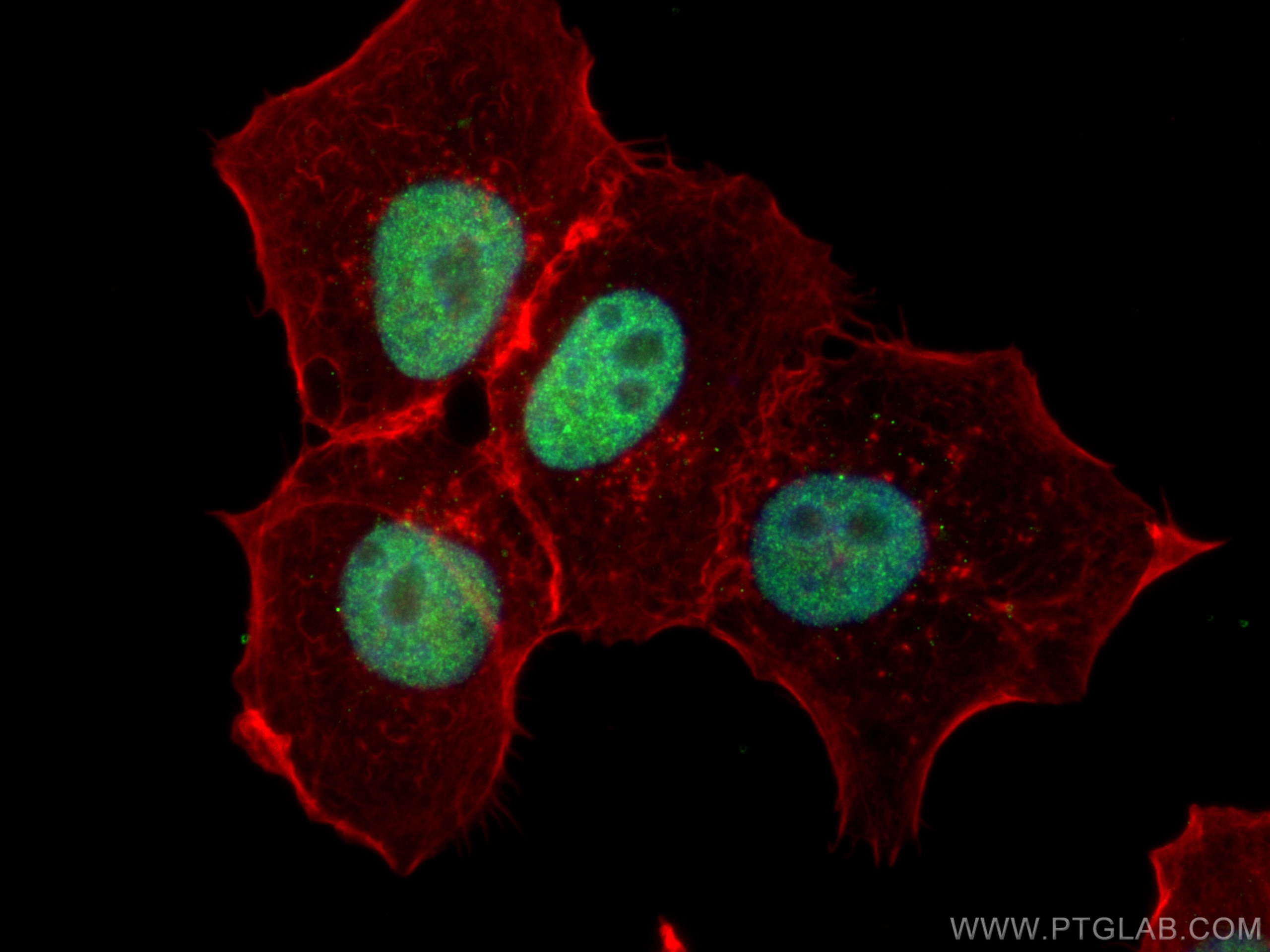 Immunofluorescence (IF) / fluorescent staining of A431 cells using ETS1 Monoclonal antibody (66598-1-Ig)