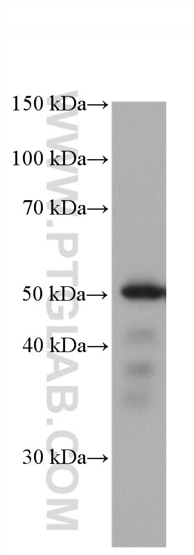 Western Blot (WB) analysis of Jurkat cells using ETS1 Monoclonal antibody (66598-1-Ig)