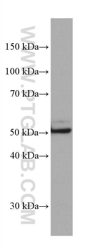 Western Blot (WB) analysis of HSC-T6 cells using ETS1 Monoclonal antibody (66598-1-Ig)