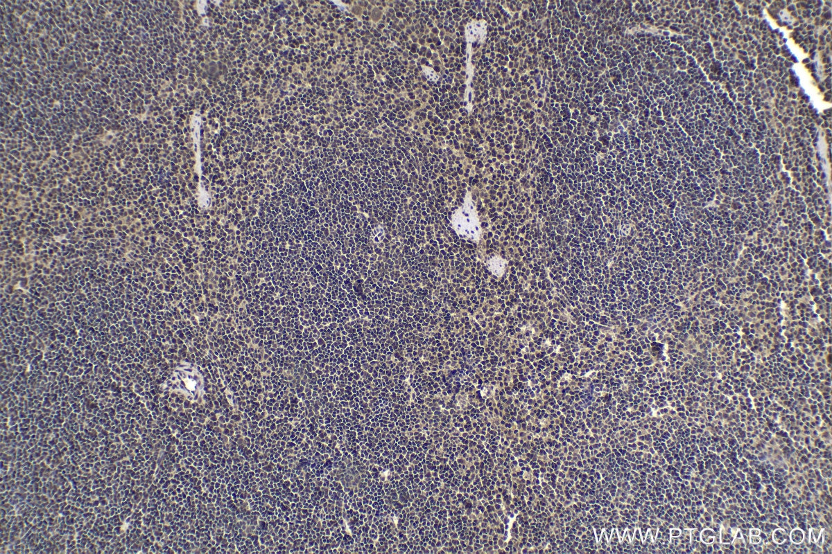 Immunohistochemistry (IHC) staining of mouse spleen tissue using ETS2 Polyclonal antibody (12280-1-AP)