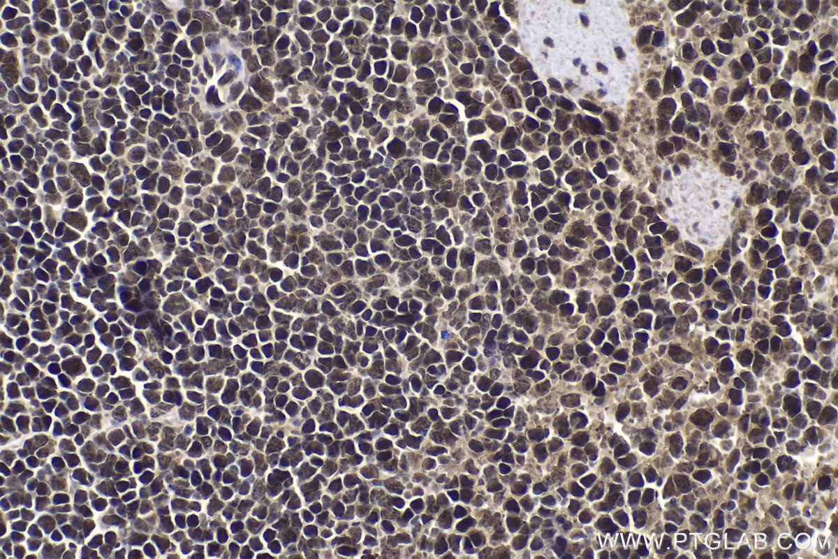 Immunohistochemistry (IHC) staining of mouse spleen tissue using ETS2 Polyclonal antibody (12280-1-AP)