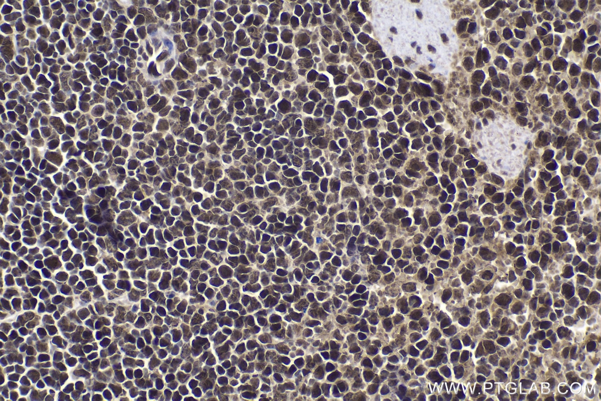 IHC staining of mouse spleen using 12280-1-AP