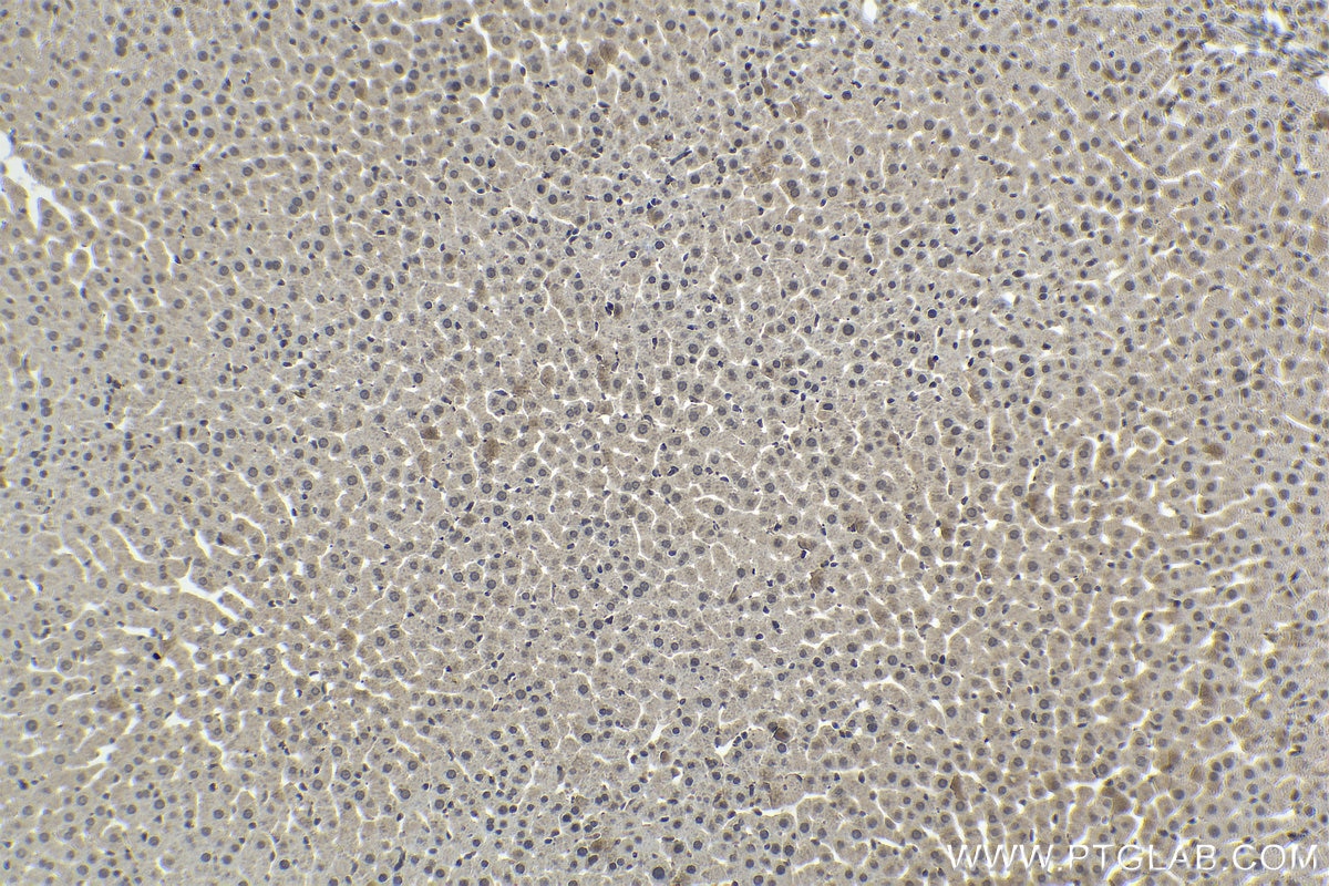 Immunohistochemistry (IHC) staining of rat liver tissue using ETS2 Polyclonal antibody (12280-1-AP)