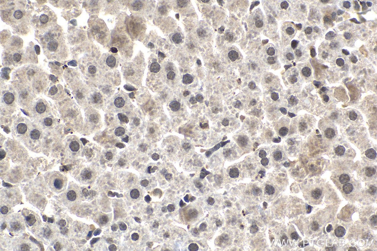 Immunohistochemistry (IHC) staining of rat liver tissue using ETS2 Polyclonal antibody (12280-1-AP)