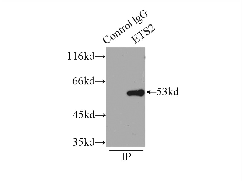 Immunoprecipitation (IP) experiment of HeLa cells using ETS2 Polyclonal antibody (12280-1-AP)