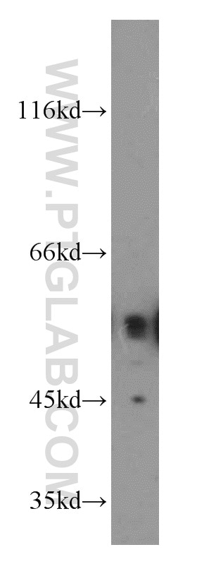 Western Blot (WB) analysis of PC-3 cells using ETS2 Polyclonal antibody (12280-1-AP)