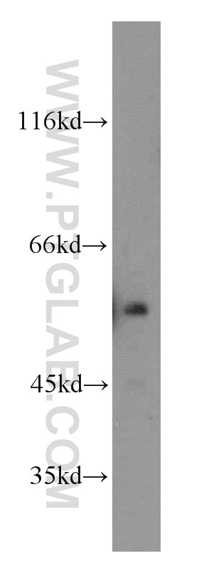 Western Blot (WB) analysis of HeLa cells using ETS2 Polyclonal antibody (12280-1-AP)