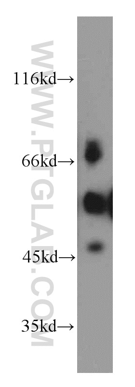 Western Blot (WB) analysis of MCF-7 cells using ETS2 Polyclonal antibody (12280-1-AP)