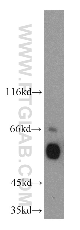 Western Blot (WB) analysis of mouse kidney tissue using ETS2 Polyclonal antibody (12280-1-AP)