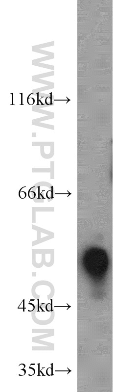 Western Blot (WB) analysis of K-562 cells using ETS2 Polyclonal antibody (12280-1-AP)
