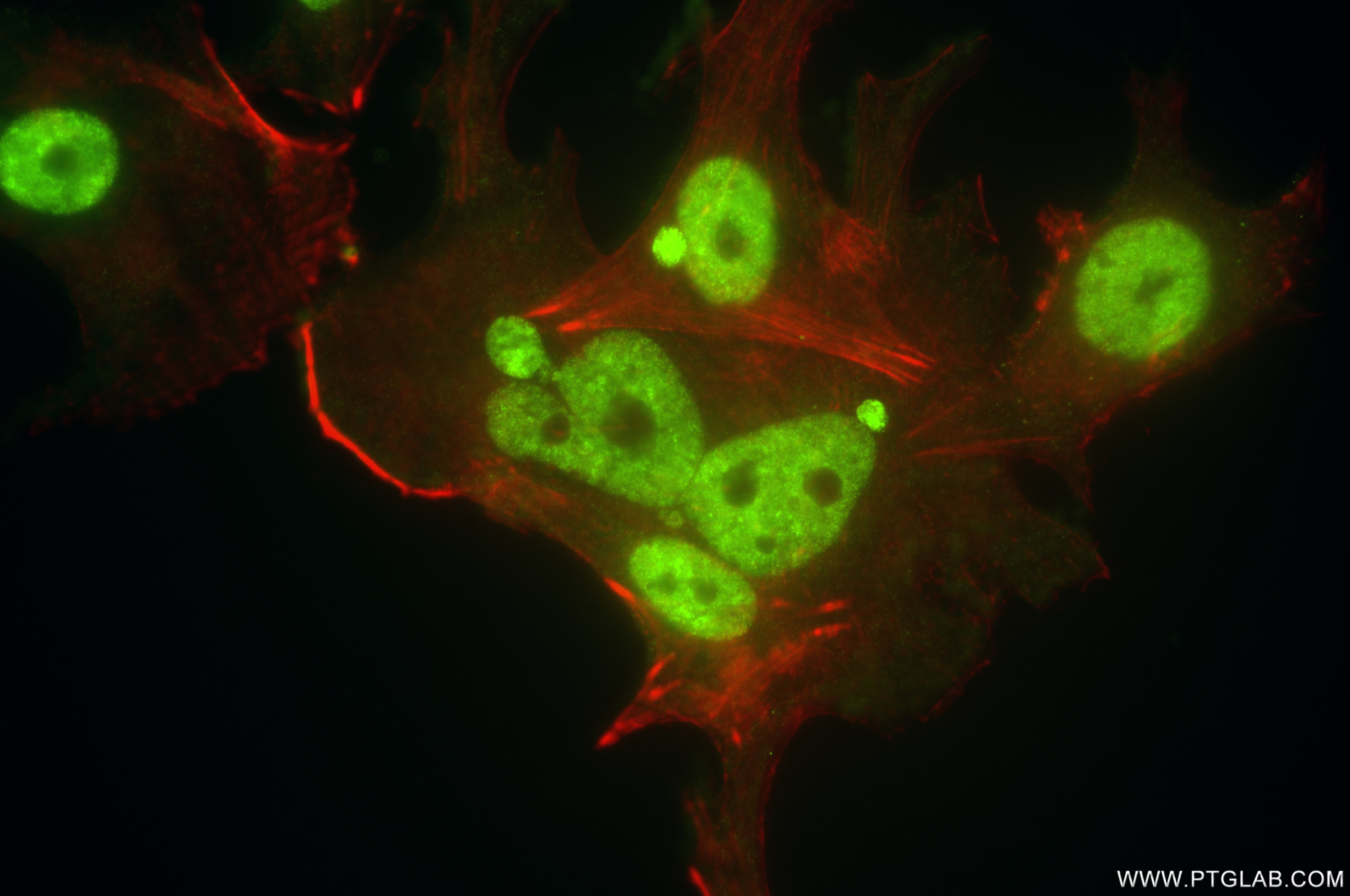 Immunofluorescence (IF) / fluorescent staining of MCF-7 cells using ETS2 Recombinant antibody (85113-4-RR)