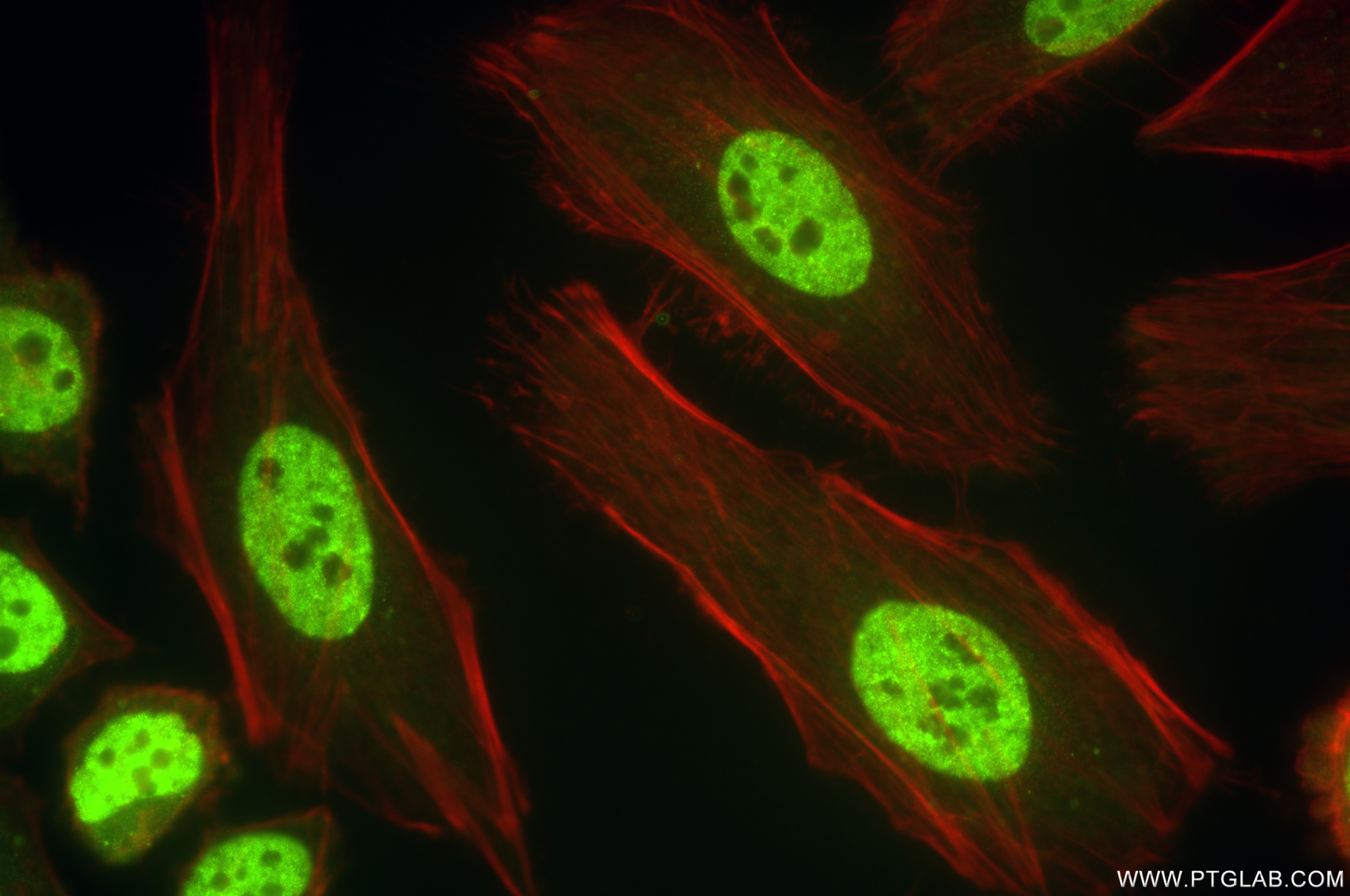 Immunofluorescence (IF) / fluorescent staining of HeLa cells using ETS2 Recombinant antibody (85113-4-RR)