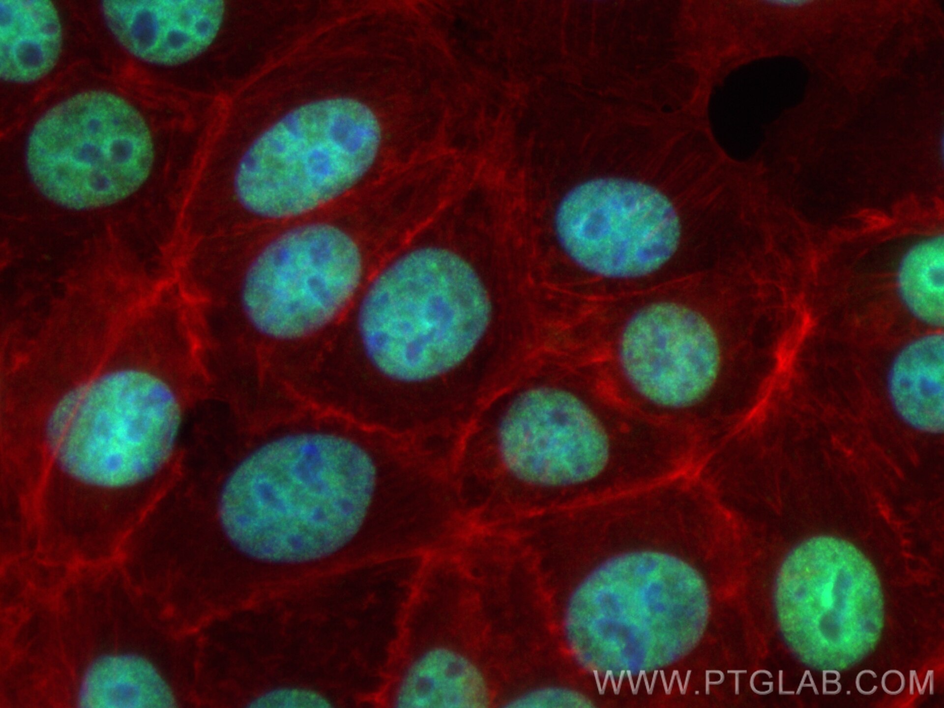 Immunofluorescence (IF) / fluorescent staining of MCF-7 cells using CoraLite® Plus 488-conjugated ETS2 Recombinant ant (CL488-85113-4)