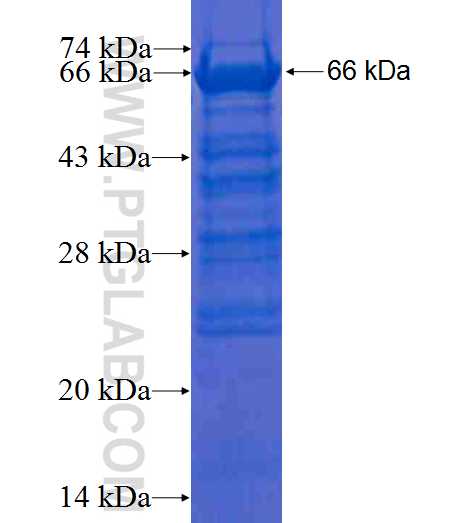 ETS2 fusion protein Ag2929 SDS-PAGE