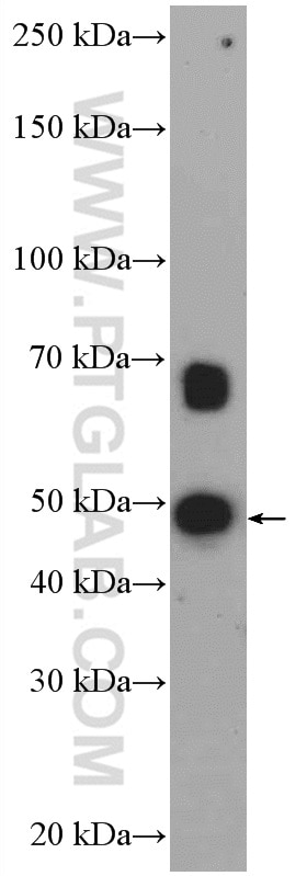 Western Blot (WB) analysis of mouse testis tissue using ETV1 Polyclonal antibody (27381-1-AP)