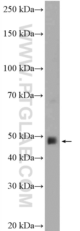 Western Blot (WB) analysis of MCF-7 cells using ETV1 Polyclonal antibody (27381-1-AP)