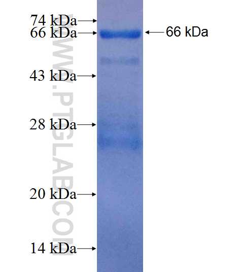ETV1 fusion protein Ag26499 SDS-PAGE
