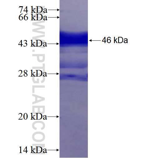 ETV1 fusion protein Ag26510 SDS-PAGE