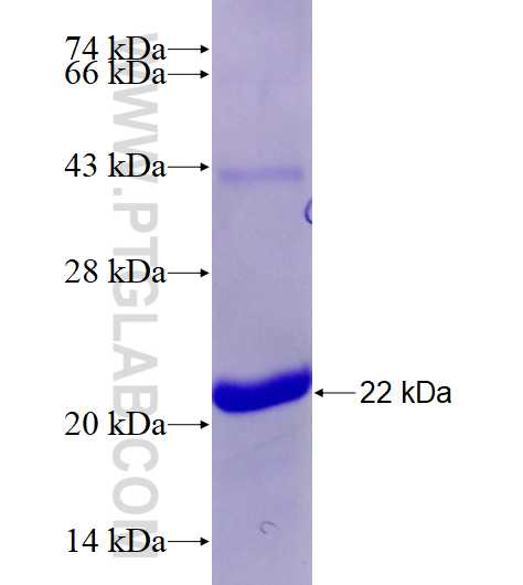 ETV1 fusion protein Ag28169 SDS-PAGE