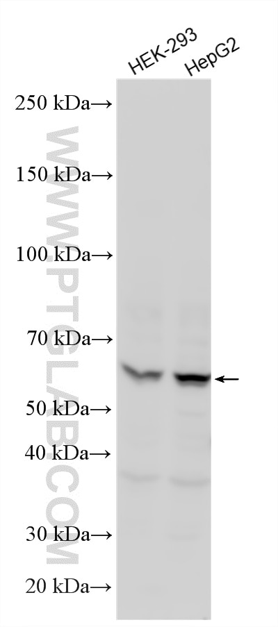 WB analysis using 11721-1-AP (same clone as 11721-1-PBS) Western Blot (WB) analysis of various lysates using ETV3 Polyclonal antibody (11721-1-AP)