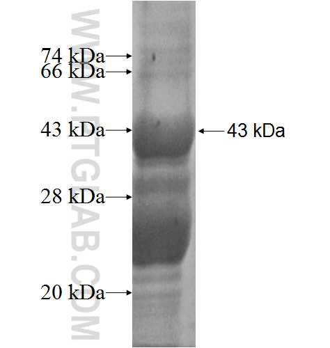 ETV3 fusion protein Ag2301 SDS-PAGE