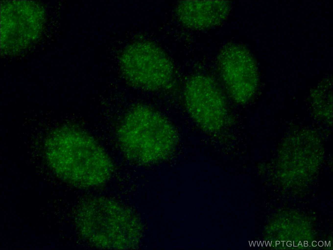 Immunofluorescence (IF) / fluorescent staining of MCF-7 cells using ETV4 Polyclonal antibody (10684-1-AP)