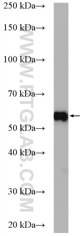 Western Blot (WB) analysis of BxPC-3 cells using ETV4 Polyclonal antibody (10684-1-AP)