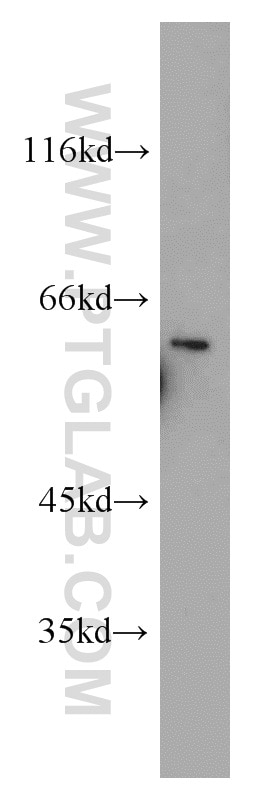 Western Blot (WB) analysis of mouse heart tissue using ETV4 Polyclonal antibody (10684-1-AP)