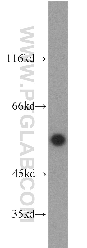 Western Blot (WB) analysis of mouse heart tissue using ETV4 Polyclonal antibody (10684-1-AP)