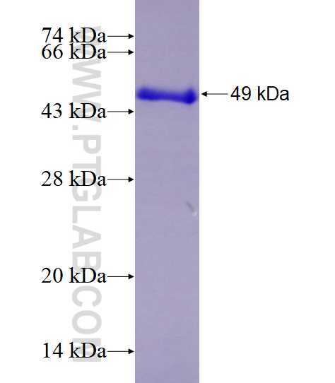 ETV4 fusion protein Ag0984 SDS-PAGE