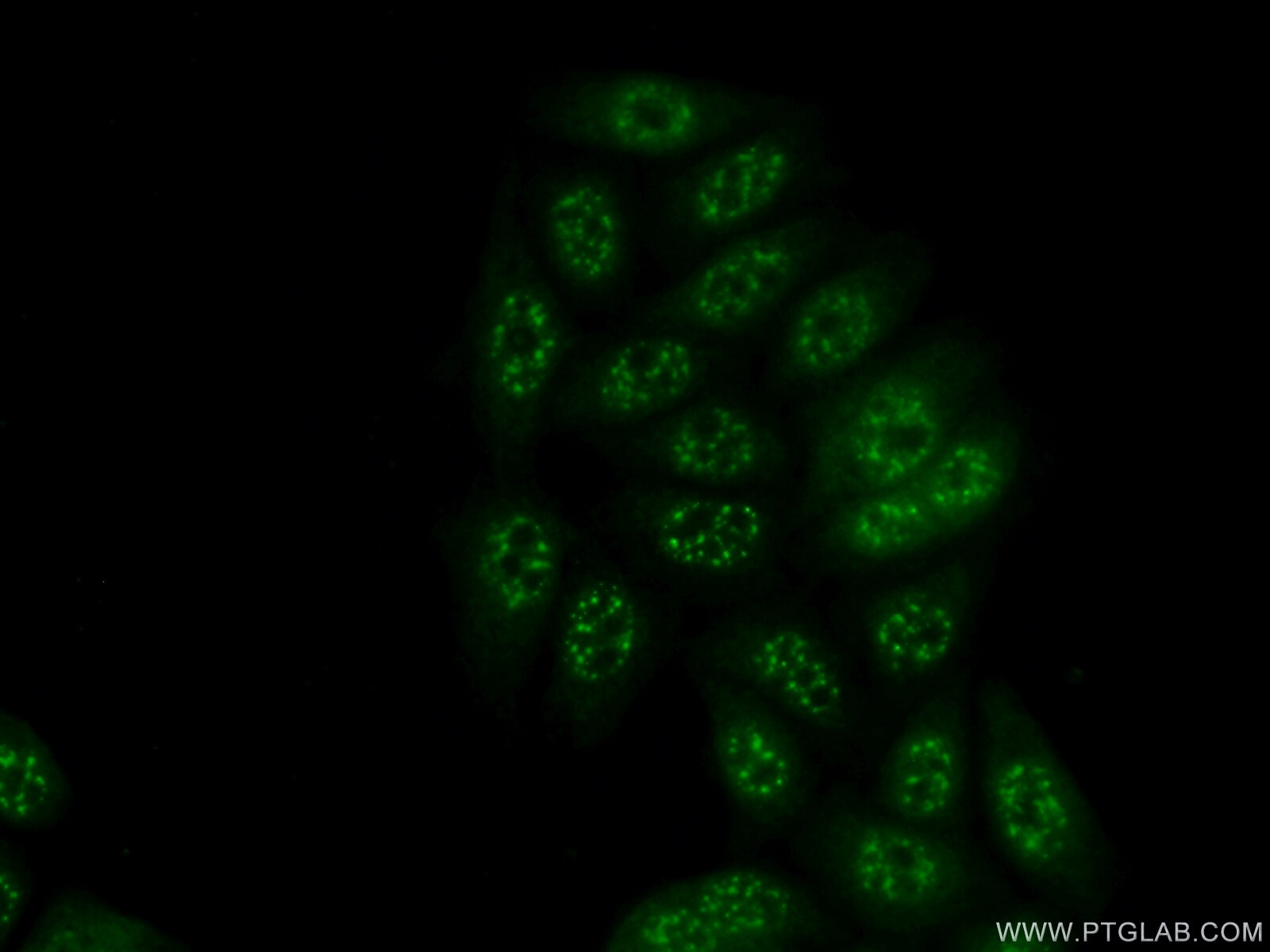 Immunofluorescence (IF) / fluorescent staining of PC-3 cells using ETV5 Polyclonal antibody (13011-1-AP)