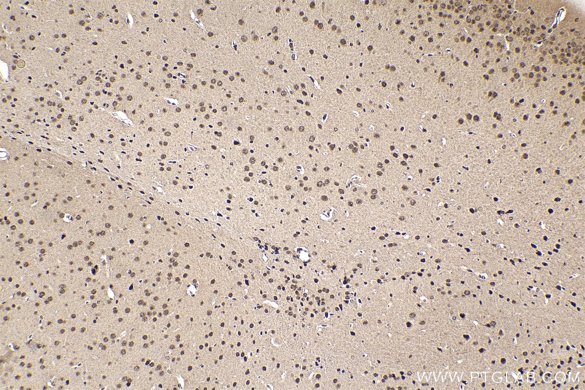 Immunohistochemistry (IHC) staining of mouse brain tissue using ETV5 Polyclonal antibody (13011-1-AP)