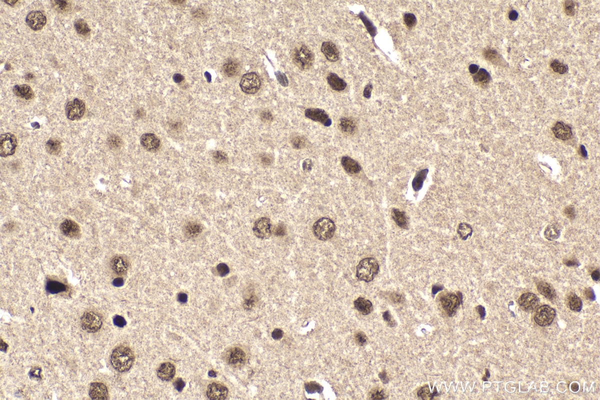 Immunohistochemistry (IHC) staining of mouse brain tissue using ETV5 Polyclonal antibody (13011-1-AP)