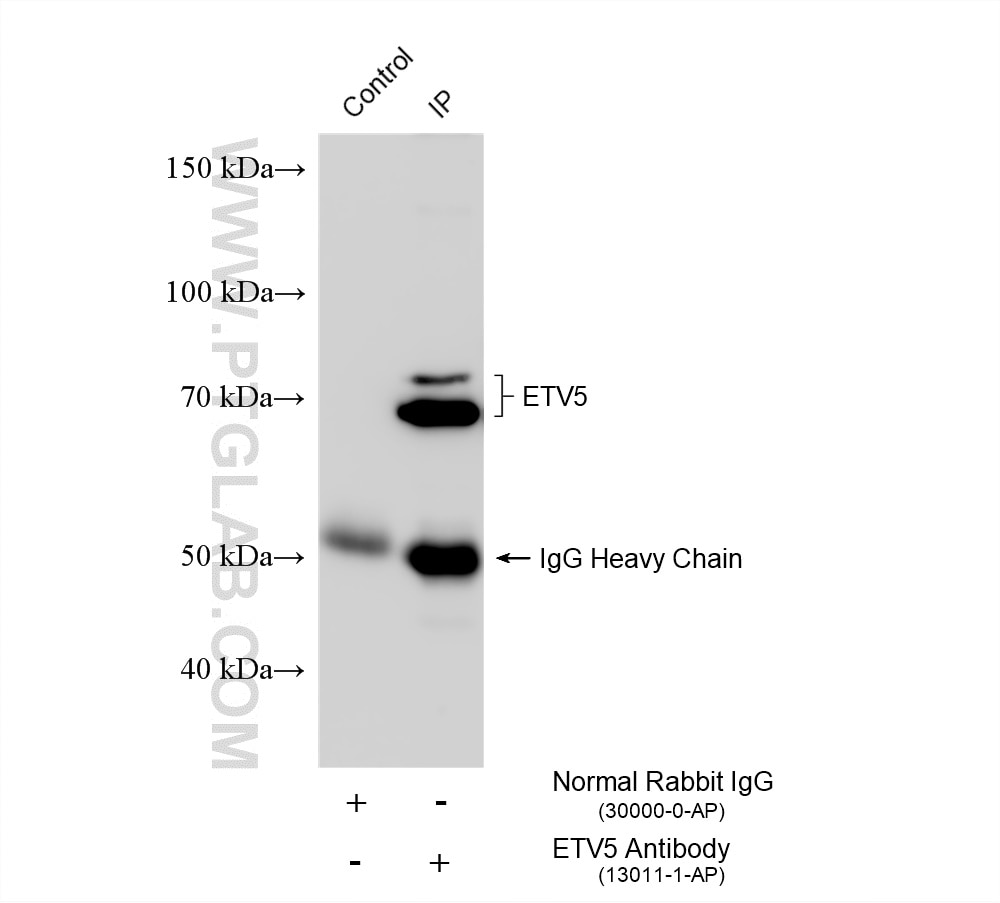 Immunoprecipitation (IP) experiment of HeLa cells using ETV5 Polyclonal antibody (13011-1-AP)