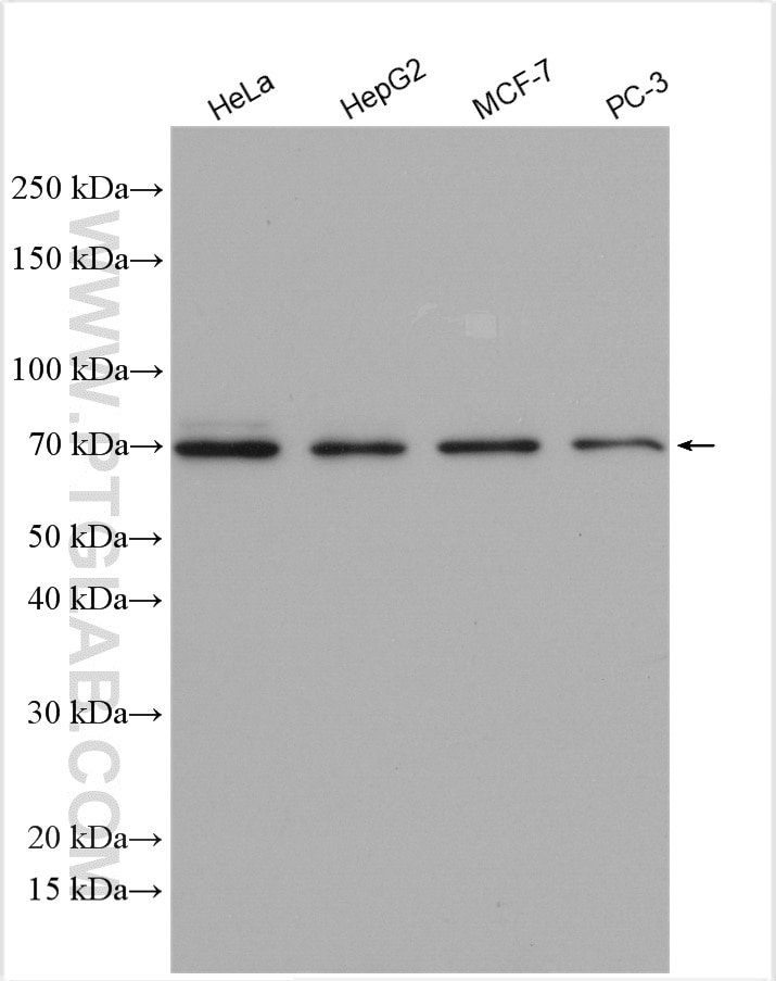 Western Blot (WB) analysis of various lysates using ETV5 Polyclonal antibody (13011-1-AP)