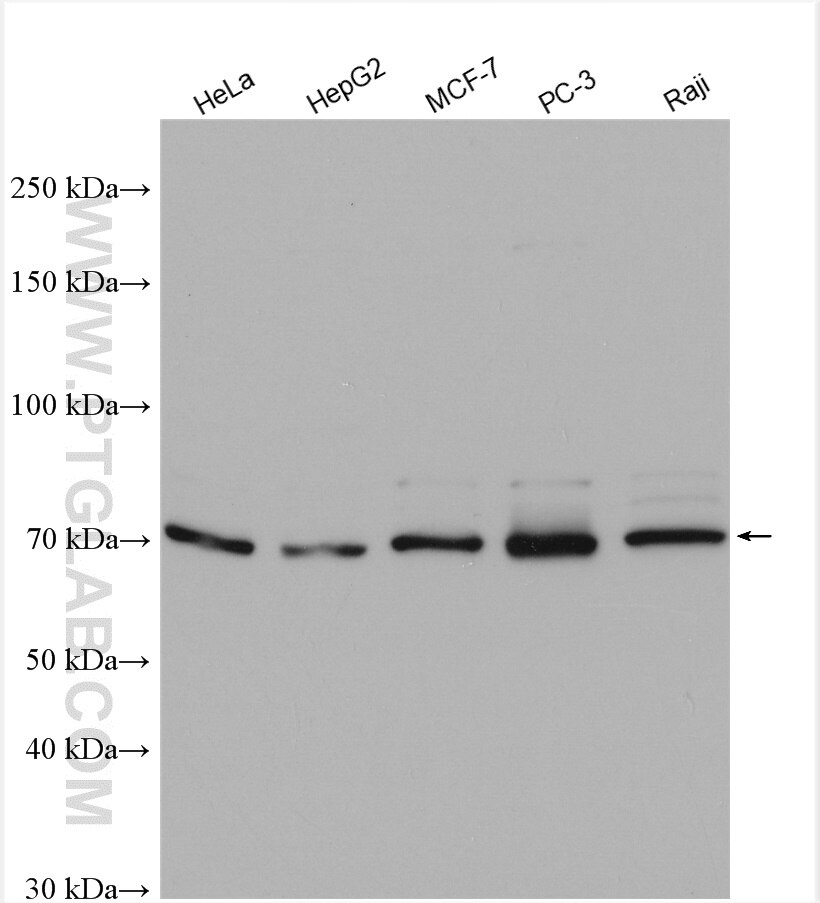 Western Blot (WB) analysis of various lysates using ETV5 Polyclonal antibody (13011-1-AP)