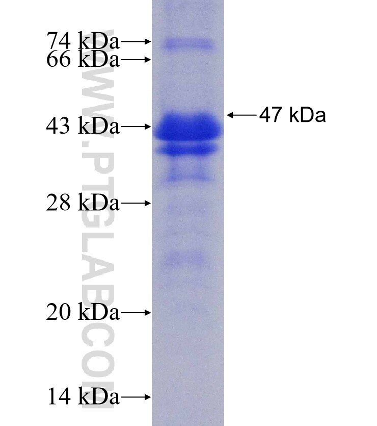 ETV5 fusion protein Ag30515 SDS-PAGE