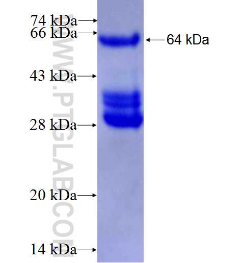 ETV5 fusion protein Ag3708 SDS-PAGE