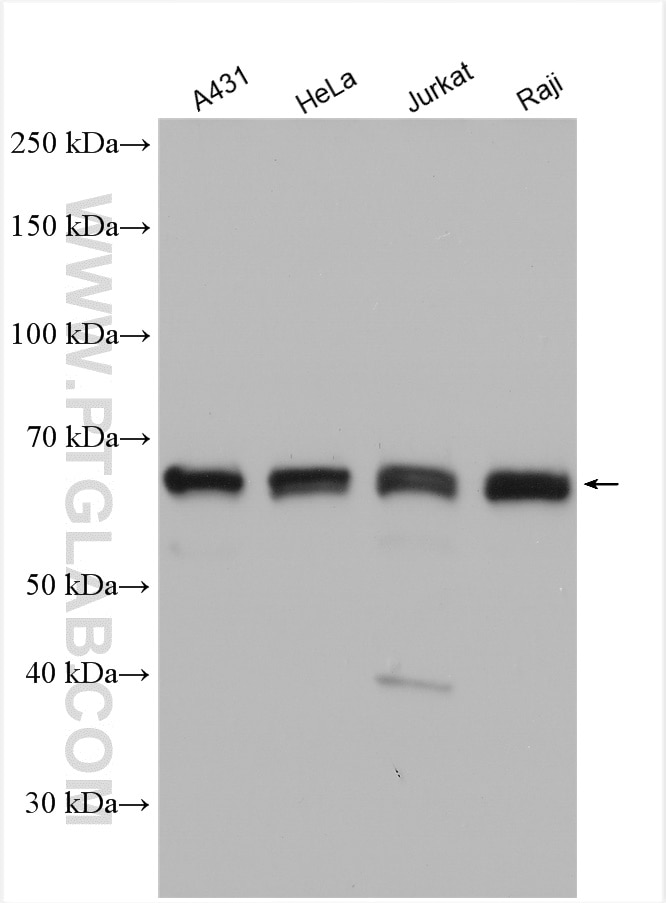 Western Blot (WB) analysis of various lysates using ETV6 Polyclonal antibody (13182-1-AP)