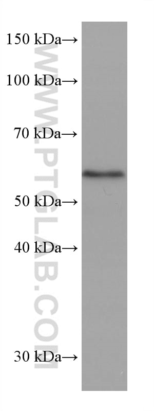 Western Blot (WB) analysis of U2OS cells using ETV6 Monoclonal antibody (67579-1-Ig)