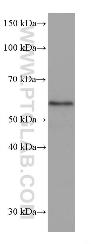 WB analysis of U2OS using 67579-1-Ig