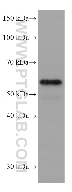 Western Blot (WB) analysis of A431 cells using ETV6 Monoclonal antibody (67579-1-Ig)
