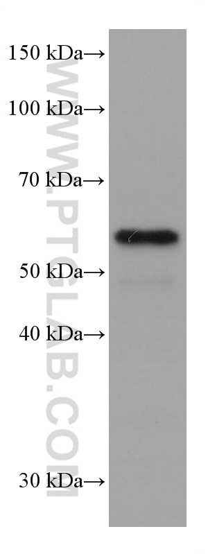 WB analysis of A431 using 67579-1-Ig