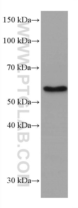Western Blot (WB) analysis of Jurkat cells using ETV6 Monoclonal antibody (67579-1-Ig)