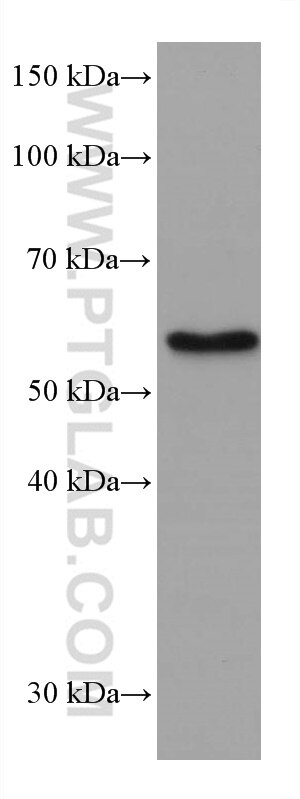 WB analysis of Jurkat using 67579-1-Ig