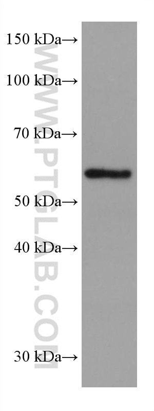 Western Blot (WB) analysis of K-562 cells using ETV6 Monoclonal antibody (67579-1-Ig)