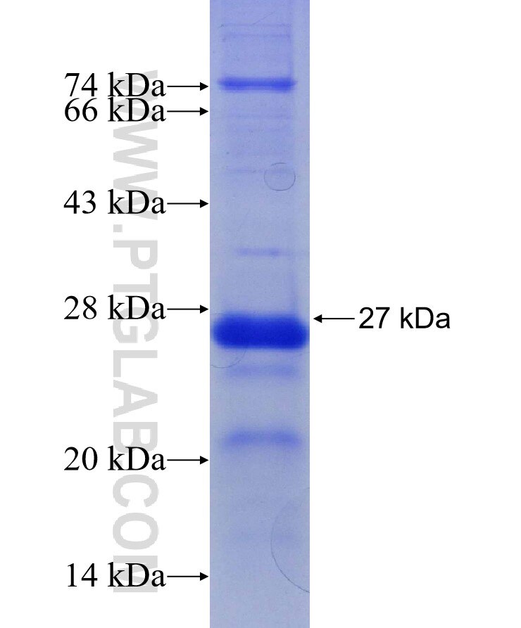 ETV6 fusion protein Ag30054 SDS-PAGE