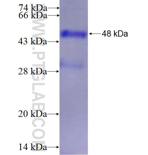 ETV6 fusion protein Ag3852 SDS-PAGE